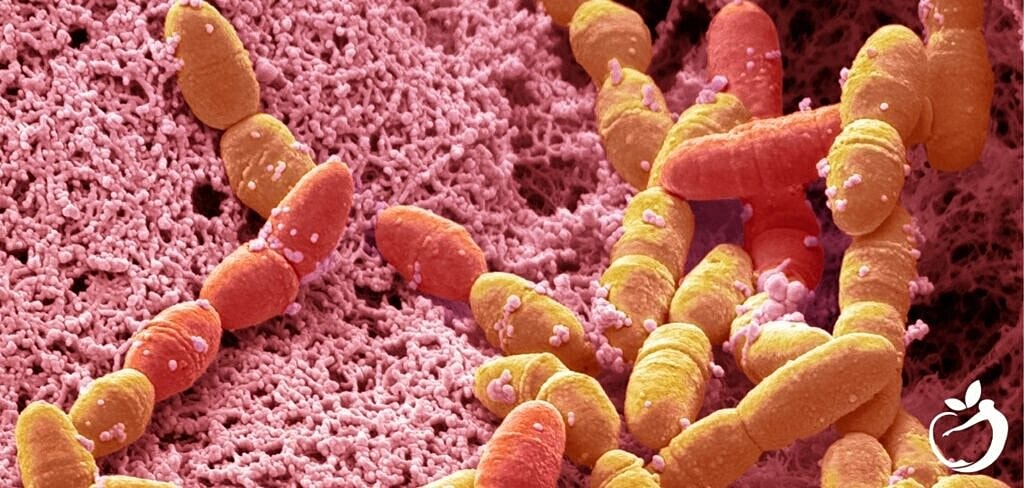 Perianal Strep: Diagnosis, Prevention, Treatment, & PANDAS - Overview of Perianal Strep