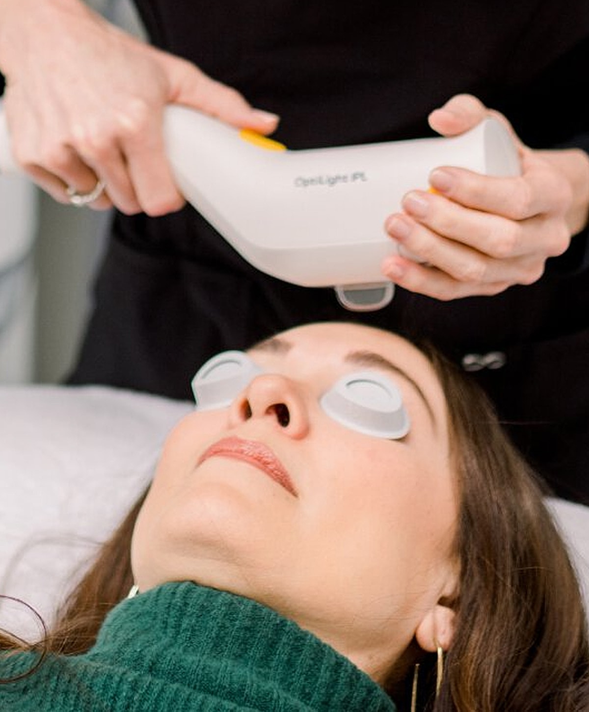 laser hair removal treatment photo