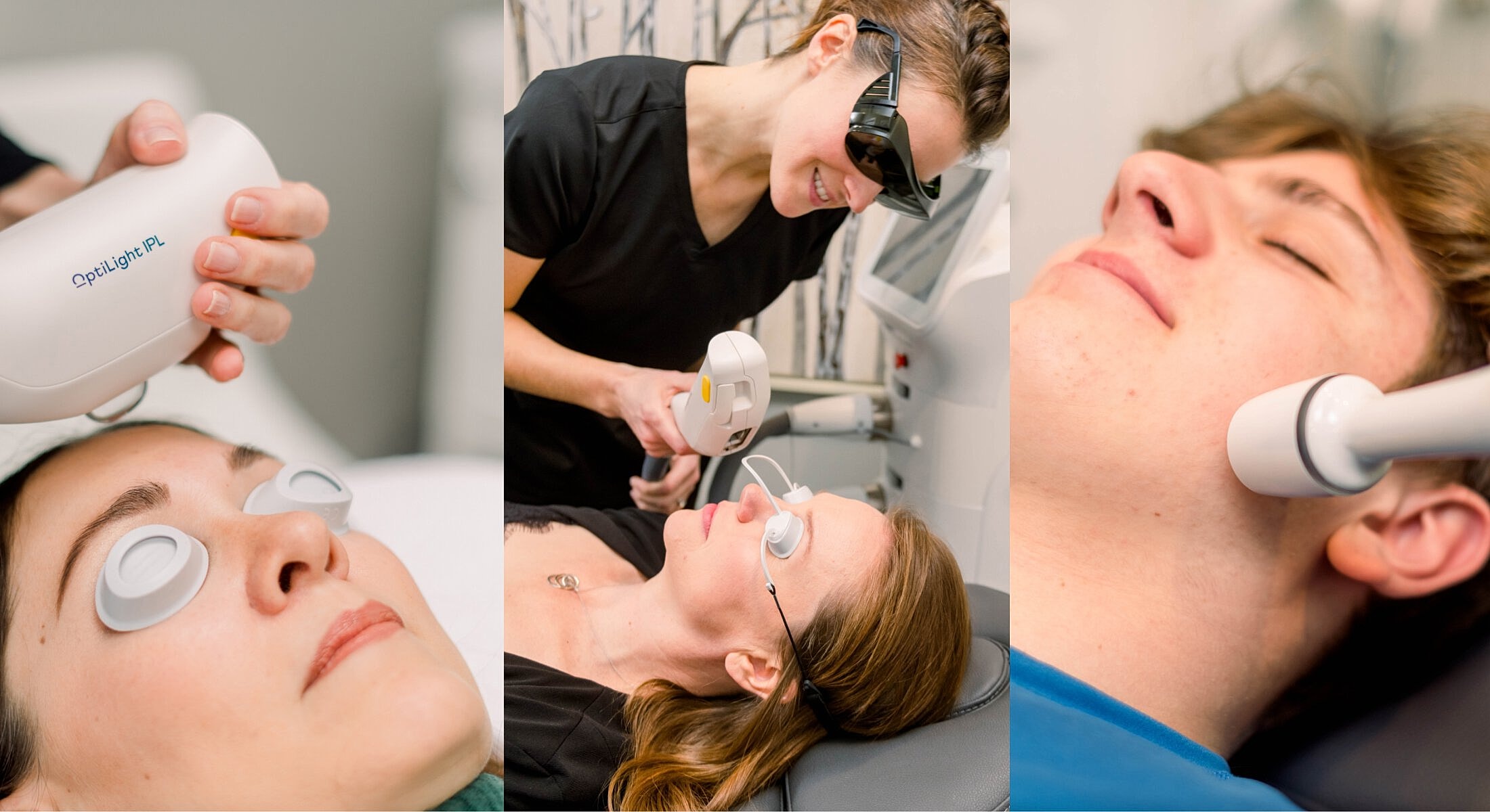 Patients receiving skincare treatments with IPL devices.