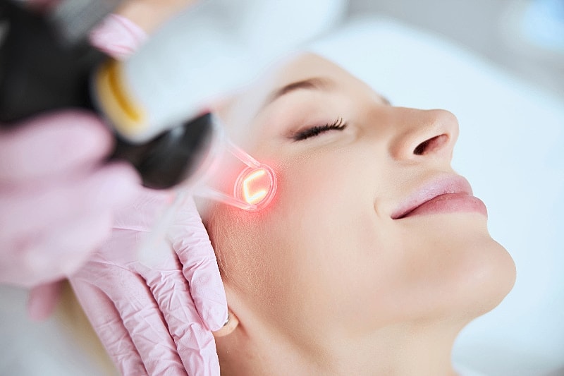Facial treatment with laser technology in progress.